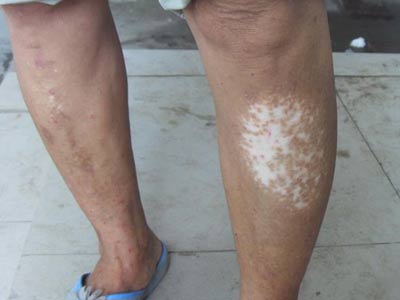 �����Ŵ������Ƕ���