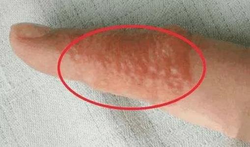 ���������ԭ������Щ��